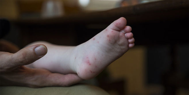 Son günlerde giderek artıyor! Çocuklarda ’kırmızı‘ alarm!