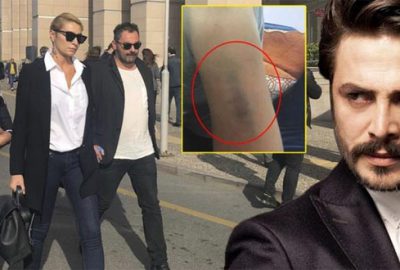 Şok gelişme! Adli Tıp, ‘Morluklar gerçek değil’ dedi