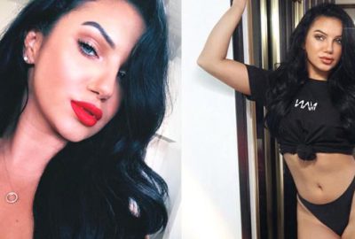 Aşk Adası’nın güzeli, tanınmaz halde! Yüzünü gören şoke oldu