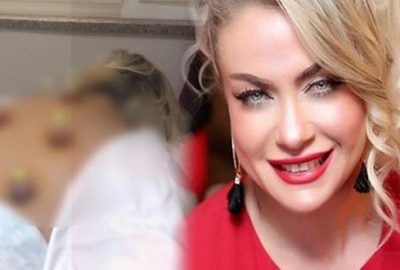 Yeliz Yeşimen’in hacamat videosu olay oldu! Tepki yağıyor