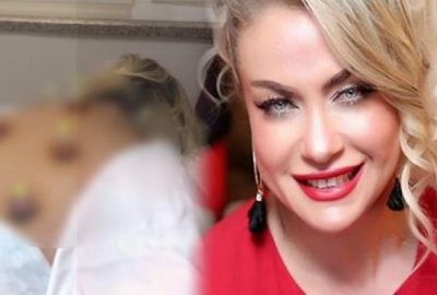 Yeliz Yeşimen’in hacamat videosu olay oldu! Tepki yağıyor