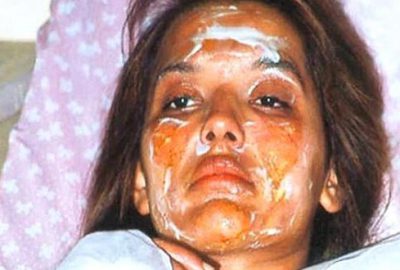 Demet Akalın’ın doğum günü kutlaması faciaya dönüştü