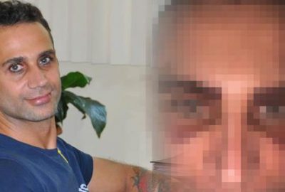 Doğuş’tan imaj çalışması! Yüzü mosmor oldu