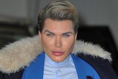 Estetik bağımlısı Ken Bebek’in son hali korkuttu!