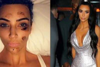 Sosyal medya sallandı! Kim Kardashian’a ne oldu?
