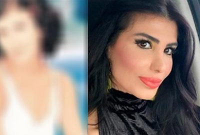 Şarkıcı Hatice’nin ‘Hatice’ye değil, neticeye bak’ dedirtecek şoke eden değişimi