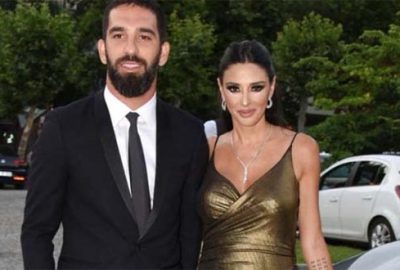 Arda’nın eşi estetiğin dozunu kaçırdı! Son hali herkesi şaşırttı