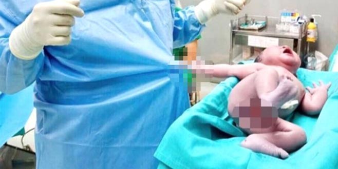 Yeni doğan bebeğin doktora yaptığı hareket sosyal medyayı salladı!