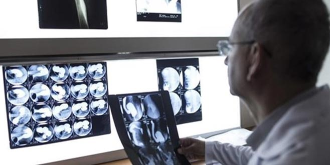 Türk bilim dünyasından önemli buluş!