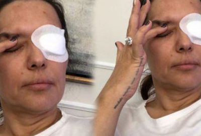 Demet Akalın ameliyattan sonra paylaştı