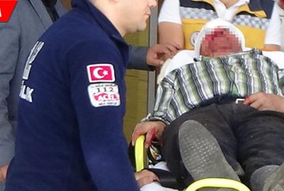 Odun keserken kanlar içerisinde kaldı