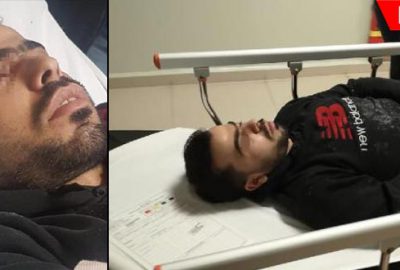 Zımba çivisi gözüne saplandı