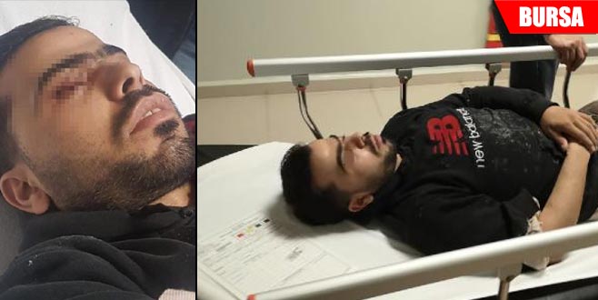 Zımba çivisi gözüne saplandı Zımba çivisi gözüne saplandı