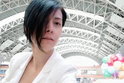 Üç böbrekli manken Türkiye’de