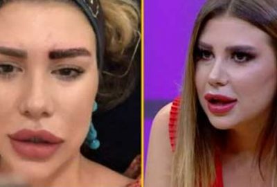 Melis Buse Betkayan’ın yaptırdığı estetik sosyal medyayı salladı