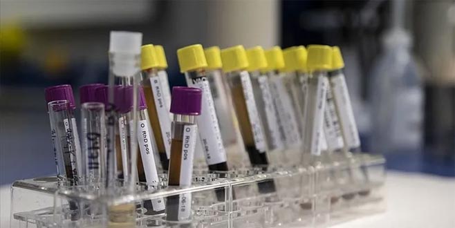 Bir dönem öldüren genetik hastalık önlenebilir hale geldi