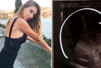 Şeyma Subaşı’nın ultrason fotoğrafı sosyal medyada gündem oldu