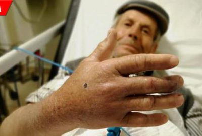 Yılanın ısırdığı çoban, hastanelik oldu