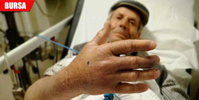 Yılanın ısırdığı çoban, hastanelik oldu