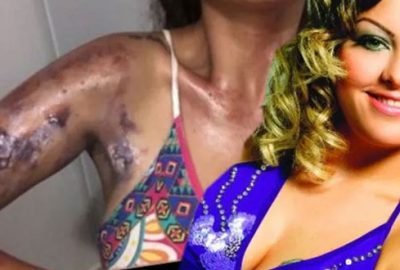 Tencere bomba gibi patladı! Ölümden döndü