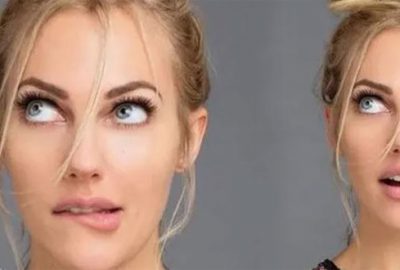 Meryem Uzerli dudak için gitti çene dolgusu yaptırdı