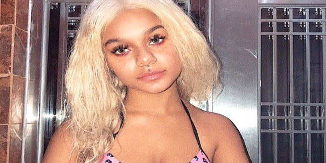 Sosyal medya fenomeni saçını düzleştirmek isterken kel kaldı!