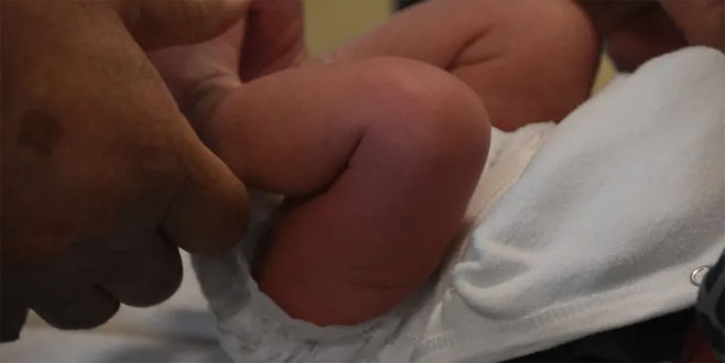 Sünnetlerin yaklaşık yüzde 20’si hatalı!