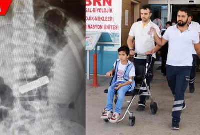 Kumanda pilini yutan Ömer hastanelik oldu