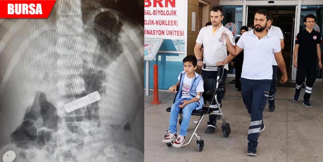 Kumanda pilini yutan Ömer hastanelik oldu