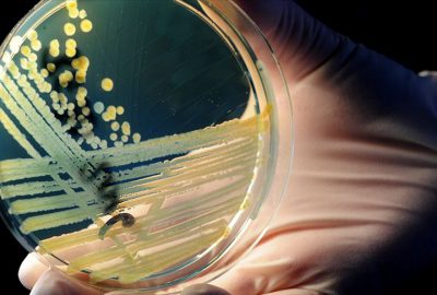 ‘2050’de antimikrobiyal direnç her yıl 10 milyon can alabilir’