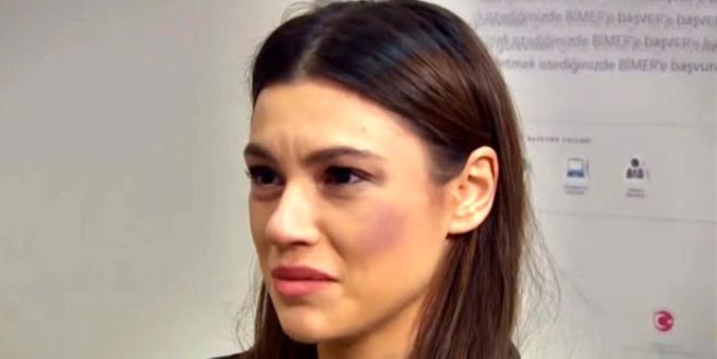 Arka Sokaklar’ın Zeliş’i, Instagram pozlarıyla kasıp kavuruyor