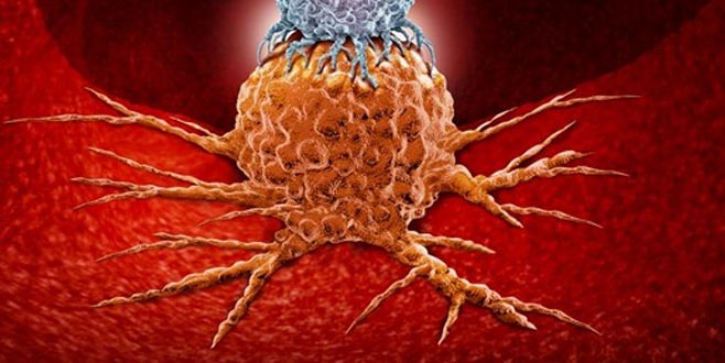 Kolon kanseri nedir? Kalın bağırsak kanseri gençlerde neden artıyor? Kolon kanseri nedir? Kalın bağırsak kanseri gençlerde neden artıyor?