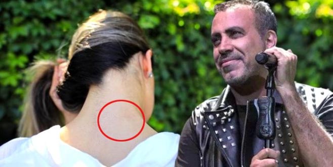 Sevgilisi tarafından 22 kez bıçaklanan genç kızın imdadına yetişti