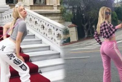 Estetik açıklaması! Kalçasına yağ enjekte ettirdi mi?