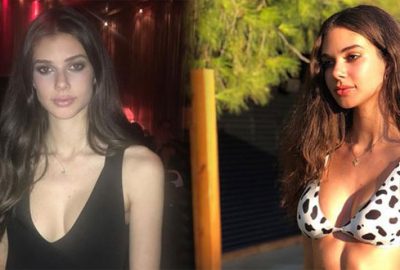 Deren Talu’nun estetiksiz hali şaşırttı!