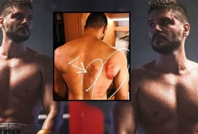 Zor anlar! Diziyi izlerken fenalaştı