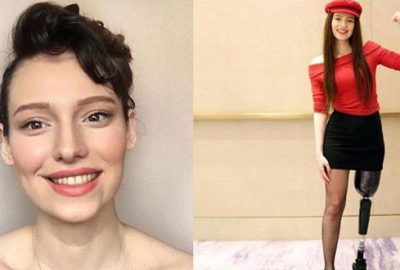 Bir bacağını kaybedip dördüncü kez kansere yakalanan Bursalı ‘Demir Kadın’