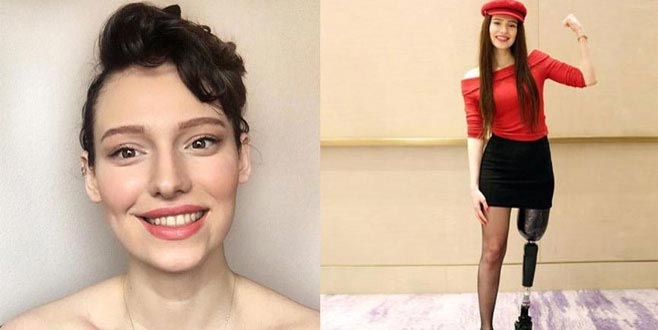 Bir bacağını kaybedip dördüncü kez kansere yakalanan Bursalı ‘Demir Kadın’