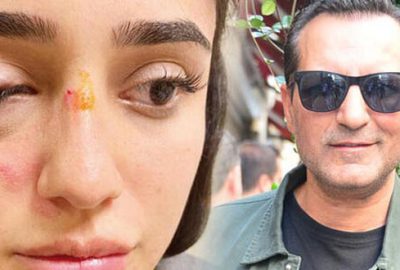 Sevgilisi Ceren Kaplakarslan’ı darp etmişti… Eski eşten ilk yorum!