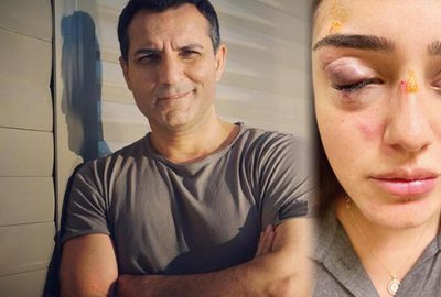 Ceren’i  öyle görünce şok oldum