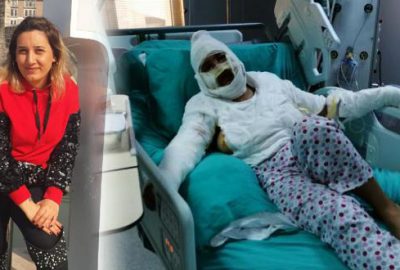 Cezaevinden izinli çıktı, eski eşini bıçaklayıp yaktı