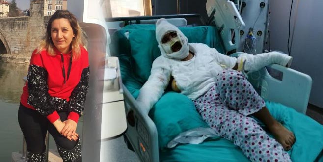 Cezaevinden izinli çıktı, eski eşini bıçaklayıp yaktı