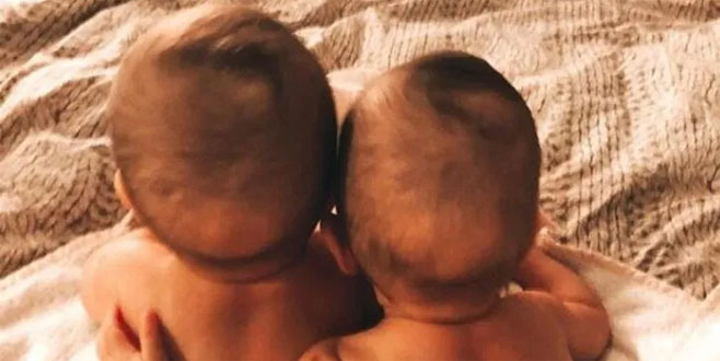 Anıl Altan ikizlerini paylaştı! ‘Anne karnından sonsuza kadar el ele…’