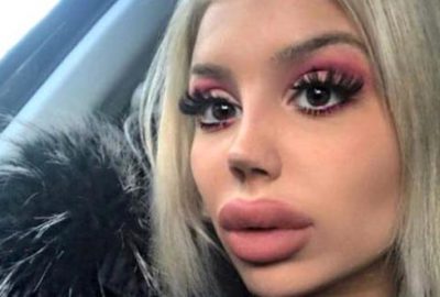 Her şey Barbie olmak için! Estetik operasyonlara yılda 104 bin TL harcıyor