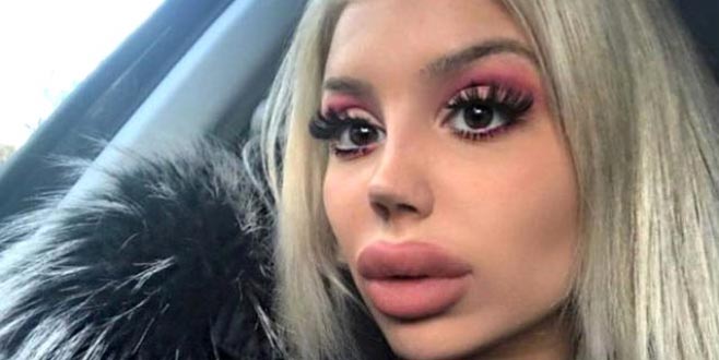 Her şey Barbie olmak için! Estetik operasyonlara yılda 104 bin TL harcıyor