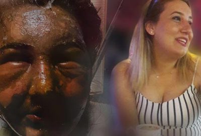 Eski karısını bu hale getirdi! ‘Önce keskin bir koku hissettim’