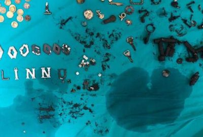 Doktorlar bile inanamadı! Midesinden çıkanlar şoke etti