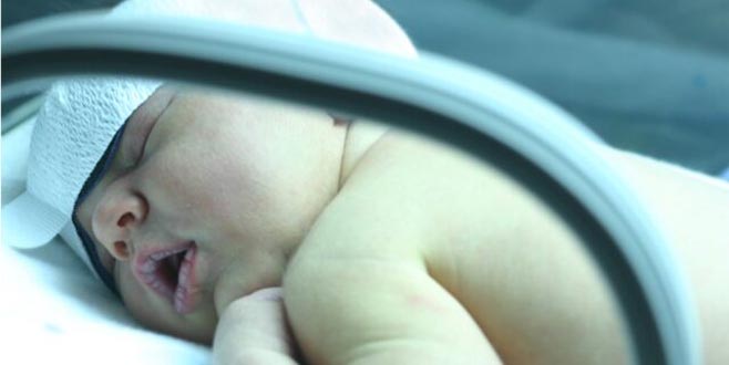 Bebeklerde uzun süren sarılığa dikkat Bebeklerde uzun süren sarılığa dikkat