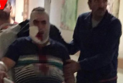 Vincin kancası yüzüne çarpan işçi ağır yaralandı