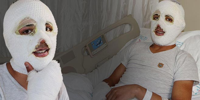 Sobaya onu dökünce hayatının şokunu yaşadı! ‘Her yer alevlerle kaplandı’